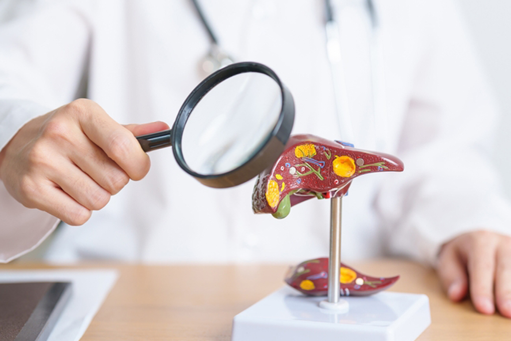 Read more about the article Understanding Non-Alcoholic Fatty Liver Disease (NAFLD): Causes, Symptoms, and Treatments